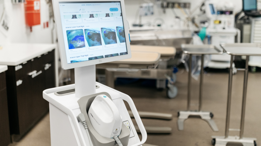 A machine is pictured in a clinical area. There is a screen and a small attachment which is used to scan the area of a patient's burn.