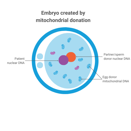 Image of an embryo created by mitochondrial donation with labels: 
patient nuclear DNA, Partner/sperm donor nuclear DNA and Egg donor mitochondrial DNA.
