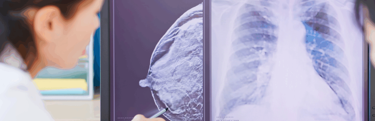 An image of medical staff looking at an X-Ray