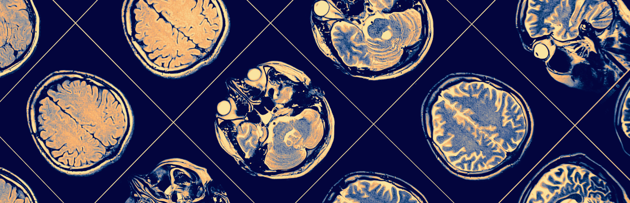 Image of brain scan